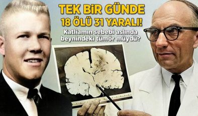 Tek bir günde 18 ölü, 31 yaralı! Katliamın sebebi beynindeki tümör mü?
