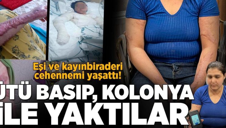 Yazgül’ün dramı! Eşi ve kayıbiraderi ütü basıp, kolonyayla yakmaya çalıştı