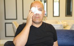 Burnu kırıldı, gözünde hasar oluştu! Saldırıya uğrayan doktor isyan etti