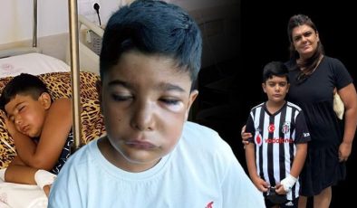 8 yaşındaki Rüzgar’ın dişi çekildi: Gözleri kapandı, hayatı kabusa döndü