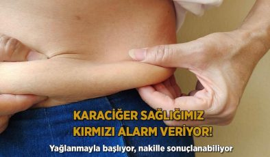Karaciğer sağlığımız kırmızı alarm veriyor! Yağlanmayla başlıyor, nakille sonuçlanabiliyor